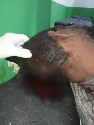 Polisi Selidiki Penembakan Karyawan Bank Papua di Kabupaten Puncak